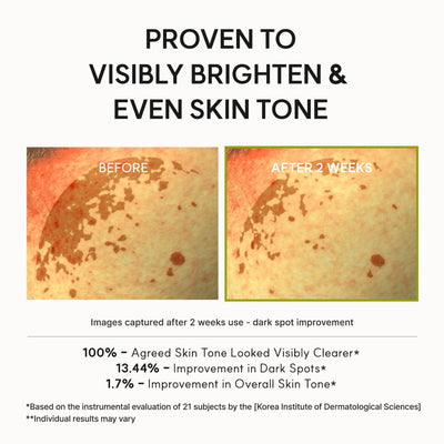 Vitamin C Booster Shot Serum
